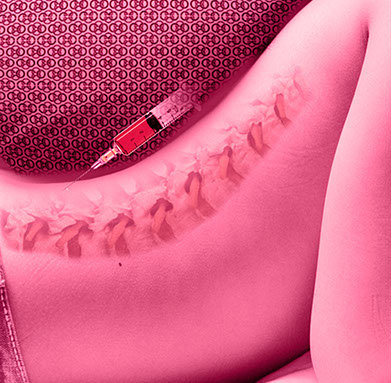 Motiv für die Infiltrationstherapie beim team CO4. Die Ansprechpartner sind Herr Dr. med. Jan-Marcel Hanssen und Herr Dr. med. Lukas Braun.