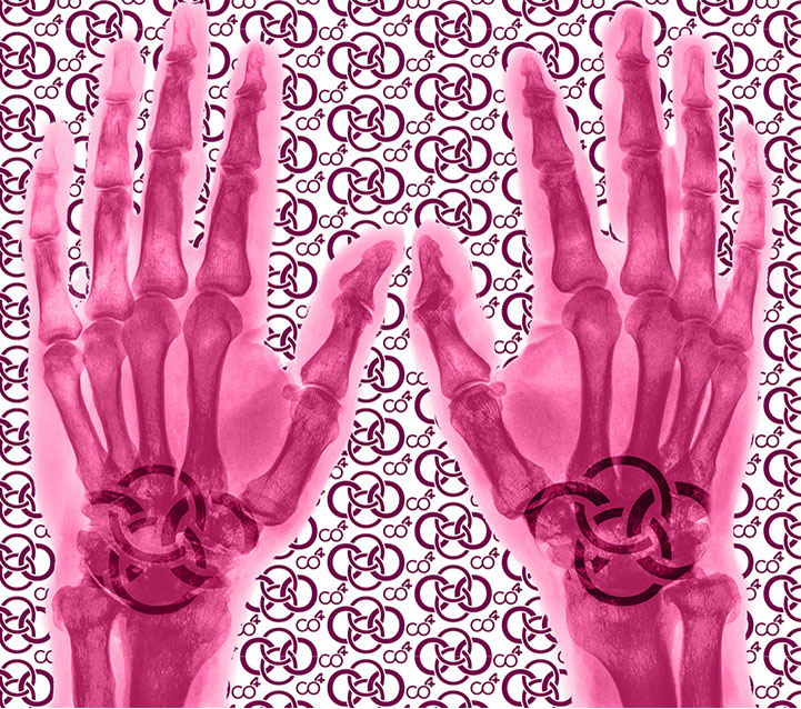 Bild Röntgenaufnahme mit Praxislogo symbolisiert Handchirurgie - eines der Fachgebiete der Praxis&nbsp; Berner´s Braun Schneider.