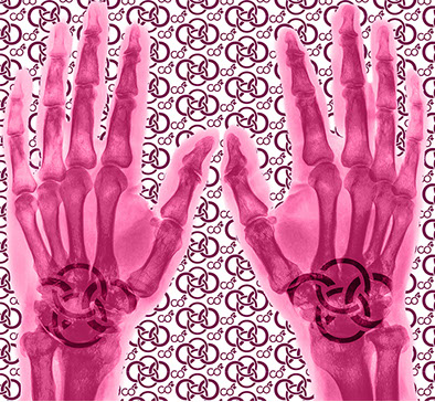 Bild Röntgenaufnahme mit Praxislogo symbolisiert Handchirurgie - eines der Fachgebiete der Praxis&nbsp; Berner´s Braun Schneider.