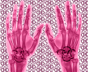 Bild Röntgenaufnahme mit Praxislogo symbolisiert Handchirurgie - eines der Fachgebiete der Praxis&nbsp; Berner´s Braun Schneider.