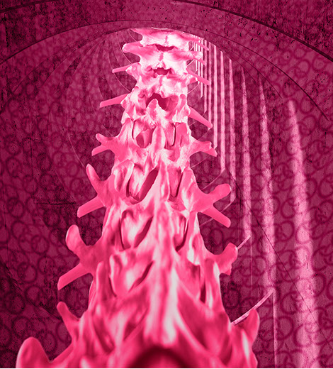 Konservative Therapie von Knochenbrüchen im Korsett. Die Ansprechpartner sind Herr Dr. med. Jan-Marcel Hanssen und Herr Dr. med. Lukas Braun.