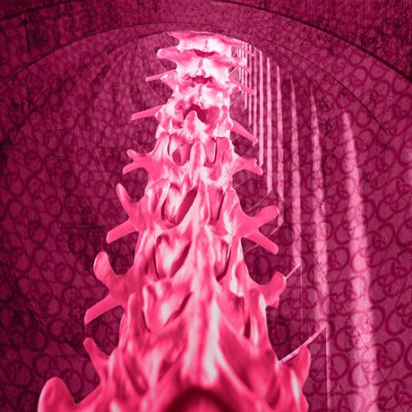 Konservative Therapie von Knochenbrüchen im Korsett. Die Ansprechpartner sind Herr Dr. med. Jan-Marcel Hanssen und Herr Dr. med. Lukas Braun.