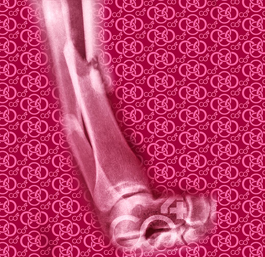 Bild Röntgenaufnahme Knochenbruch mit Praxislogo symbolisiert Fußchirurgie - eines der Fachgebiete der Praxis Berner´s Braun Schneider.