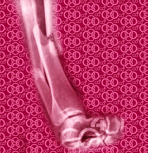 Bild Röntgenaufnahme Knochenbruch mit Praxislogo symbolisiert Fußchirurgie - eines der Fachgebiete der Praxis Berner´s Braun Schneider.