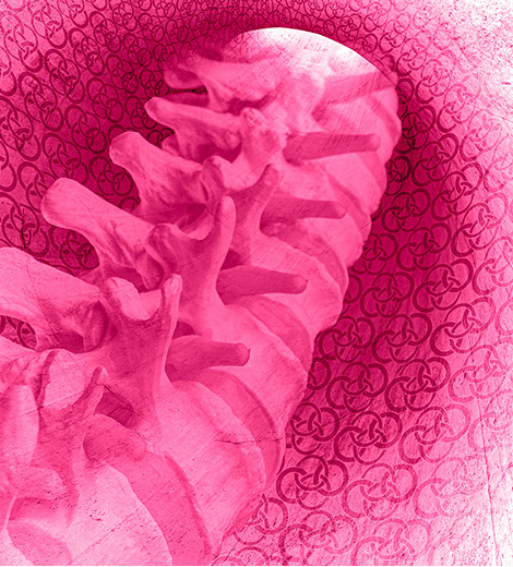 Motiv mikrochirurgische Dekompression bei Spinalkanalstenose. Fachärzte bei CO4: Herr Dr. med. Jan-Marcel Hanssen und Herr Dr. med. Lukas Braun.
