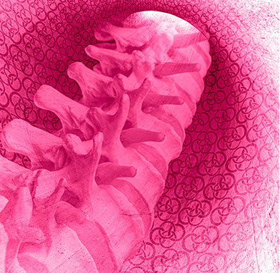 Motiv mikrochirurgische Dekompression bei Spinalkanalstenose. Fachärzte bei CO4: Herr Dr. med. Jan-Marcel Hanssen und Herr Dr. med. Lukas Braun.
