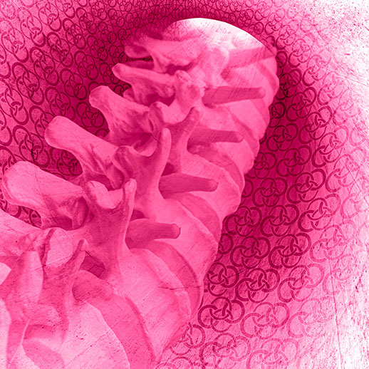 Motiv mikrochirurgische Dekompression bei Spinalkanalstenose. Fachärzte bei CO4: Herr Dr. med. Jan-Marcel Hanssen und Herr Dr. med. Lukas Braun.