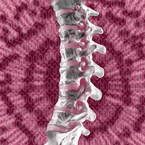 Minimalinvasive Versorgung von Knochenbrüchen der Wirbelsäule. Ansprechpartner: Herr Dr. med. Jan-Marcel Hanssen und Herr Dr. med. Lukas Braun.