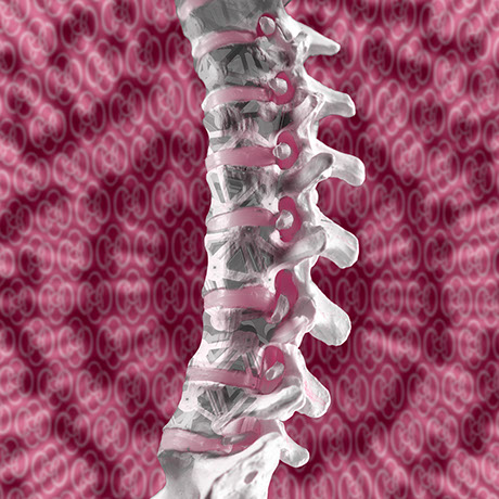 Minimalinvasive Versorgung von Knochenbrüchen der Wirbelsäule. Ansprechpartner: Herr Dr. med. Jan-Marcel Hanssen und Herr Dr. med. Lukas Braun.