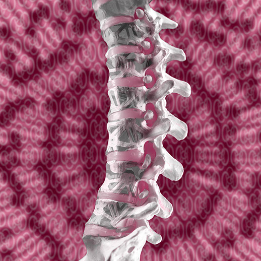 Minimalinvasive Versorgung von Knochenbrüchen der Wirbelsäule. Ansprechpartner: Herr Dr. med. Jan-Marcel Hanssen und Herr Dr. med. Lukas Braun.
