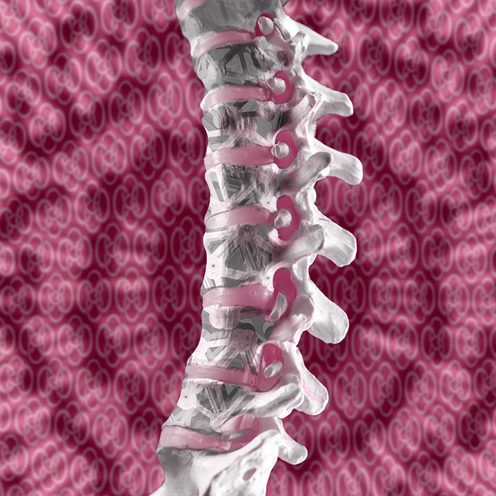 Minimalinvasive Versorgung von Knochenbrüchen der Wirbelsäule. Ansprechpartner: Herr Dr. med. Jan-Marcel Hanssen und Herr Dr. med. Lukas Braun.